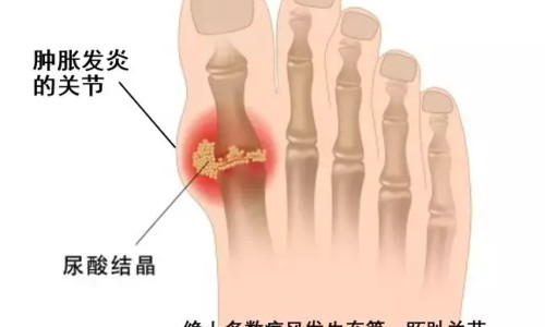 肾衰竭病人身上痒图片-肾衰竭身上会痒么网 - 网站提供肾衰竭一直发痒能活多久小常识、肾衰竭皮肤会瘙痒吗
